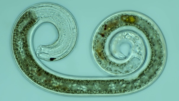 Fadenwurm (Nematode) | Bild: picture-alliance/dpa Fadenwurm (Nematode) | Bild: picture-alliance/dpa